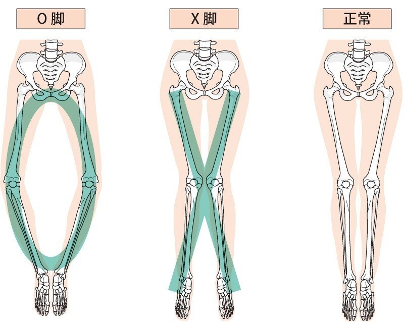 保存版 O脚とx脚を治すストレッチと筋トレの４つのポイント 動画付き 理学療法士 ピラティス カラダnote吉田直紀 Note