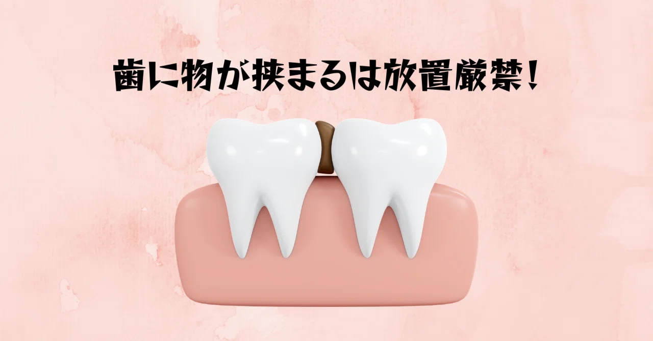 歯に物が挟まるは放置厳禁！｜いずみ中山歯科