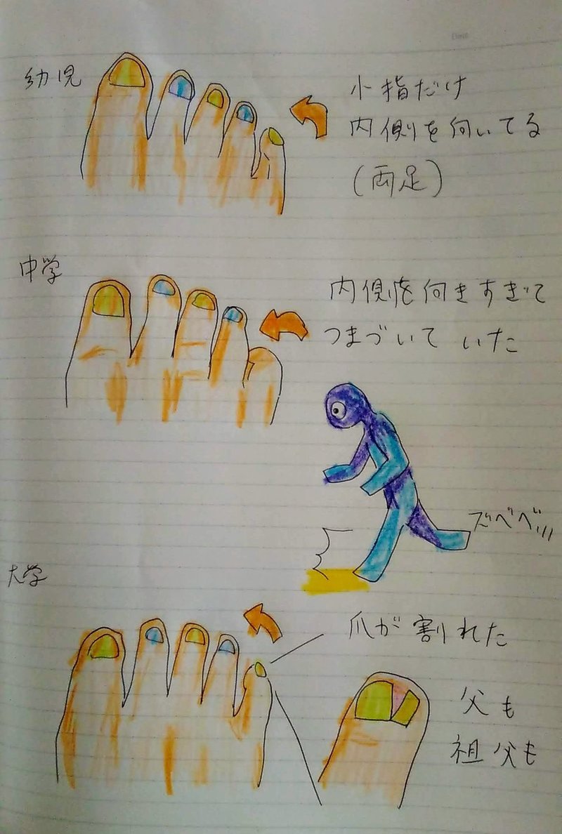 手足の指が調子良くなった グロ注意です れいな Note