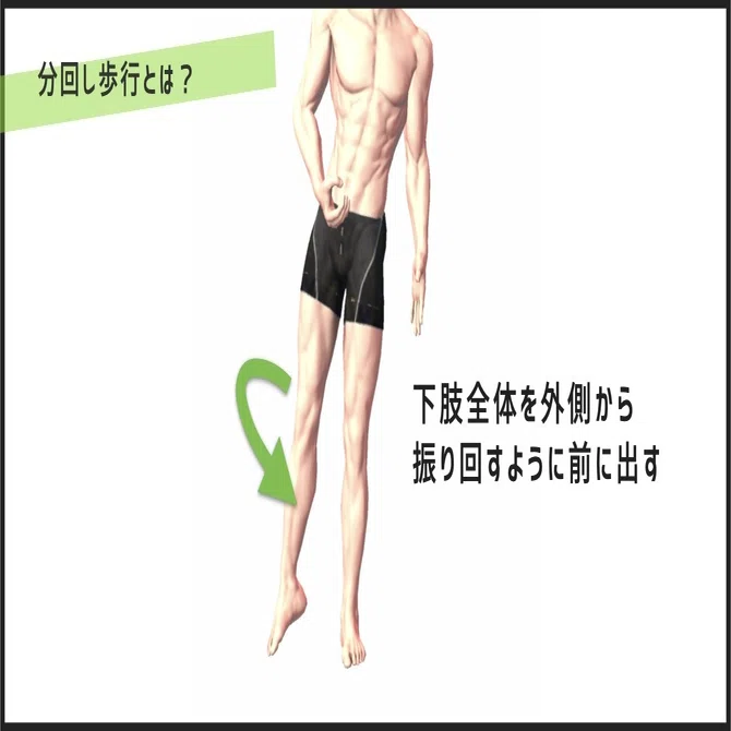ぶん 回し 歩行