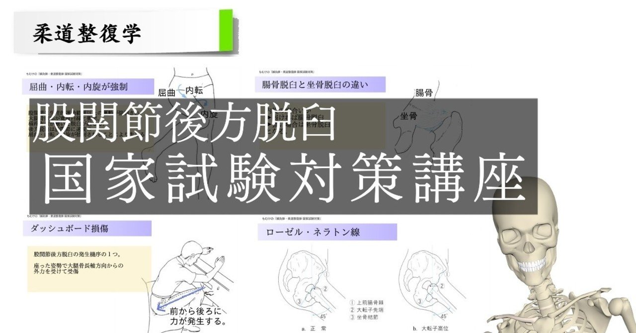 柔理 ゴロで覚える股関節後方脱臼 森元塾 国家試験対策 Note