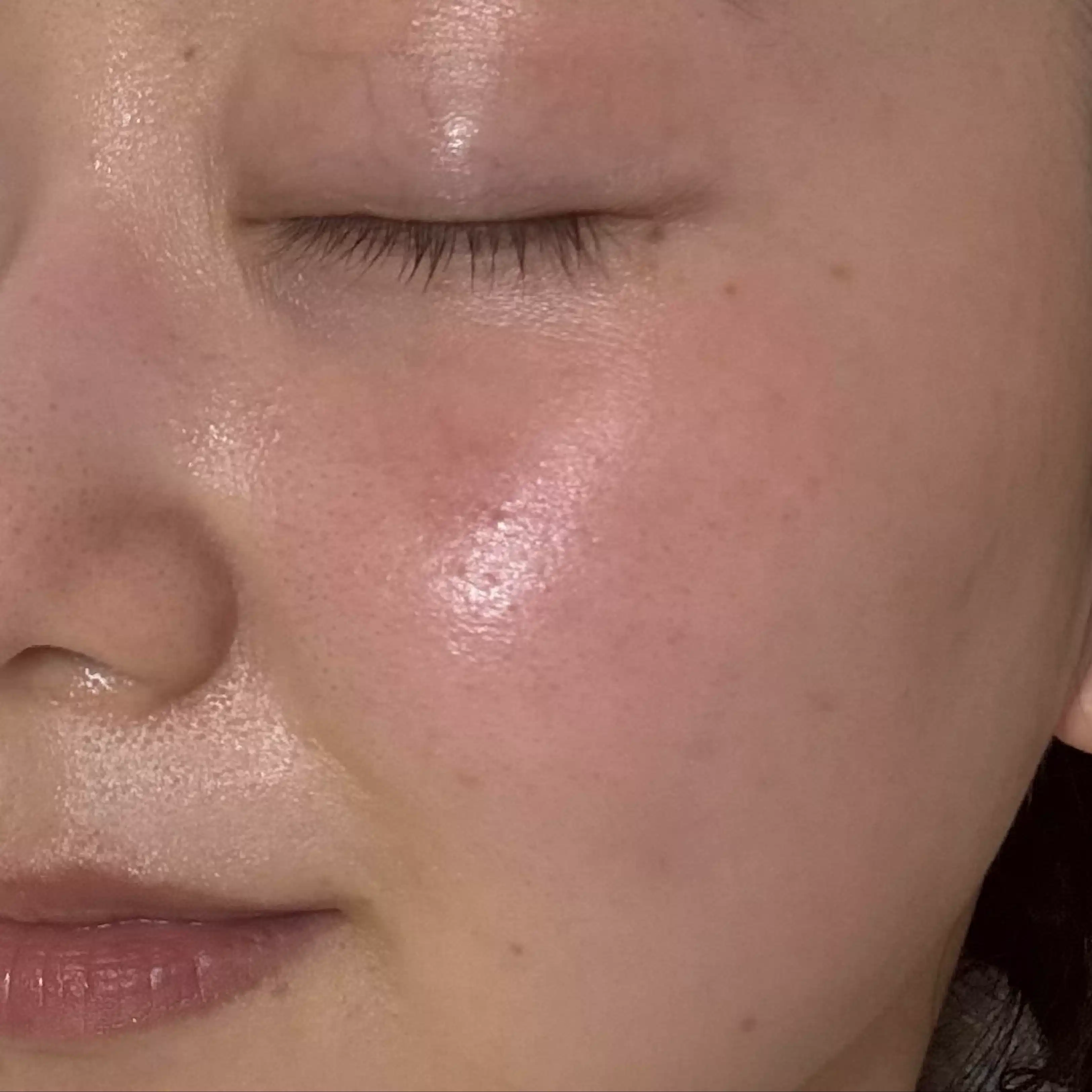 美肌研究家　美容看護師　mochi