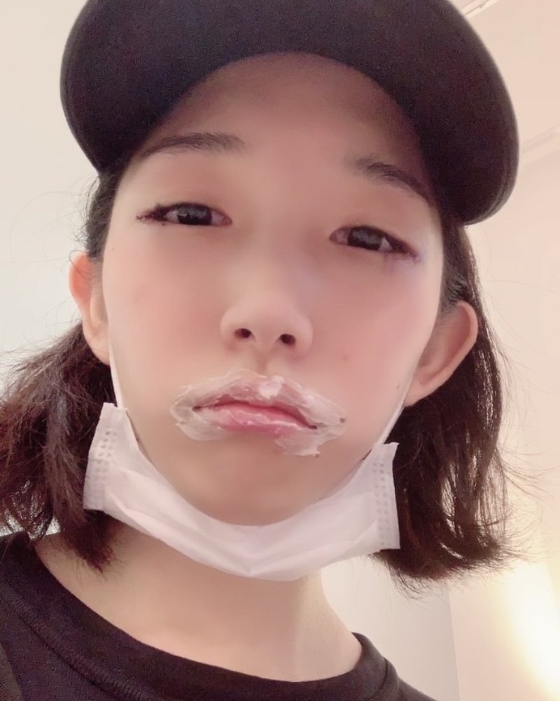 整形失敗地獄