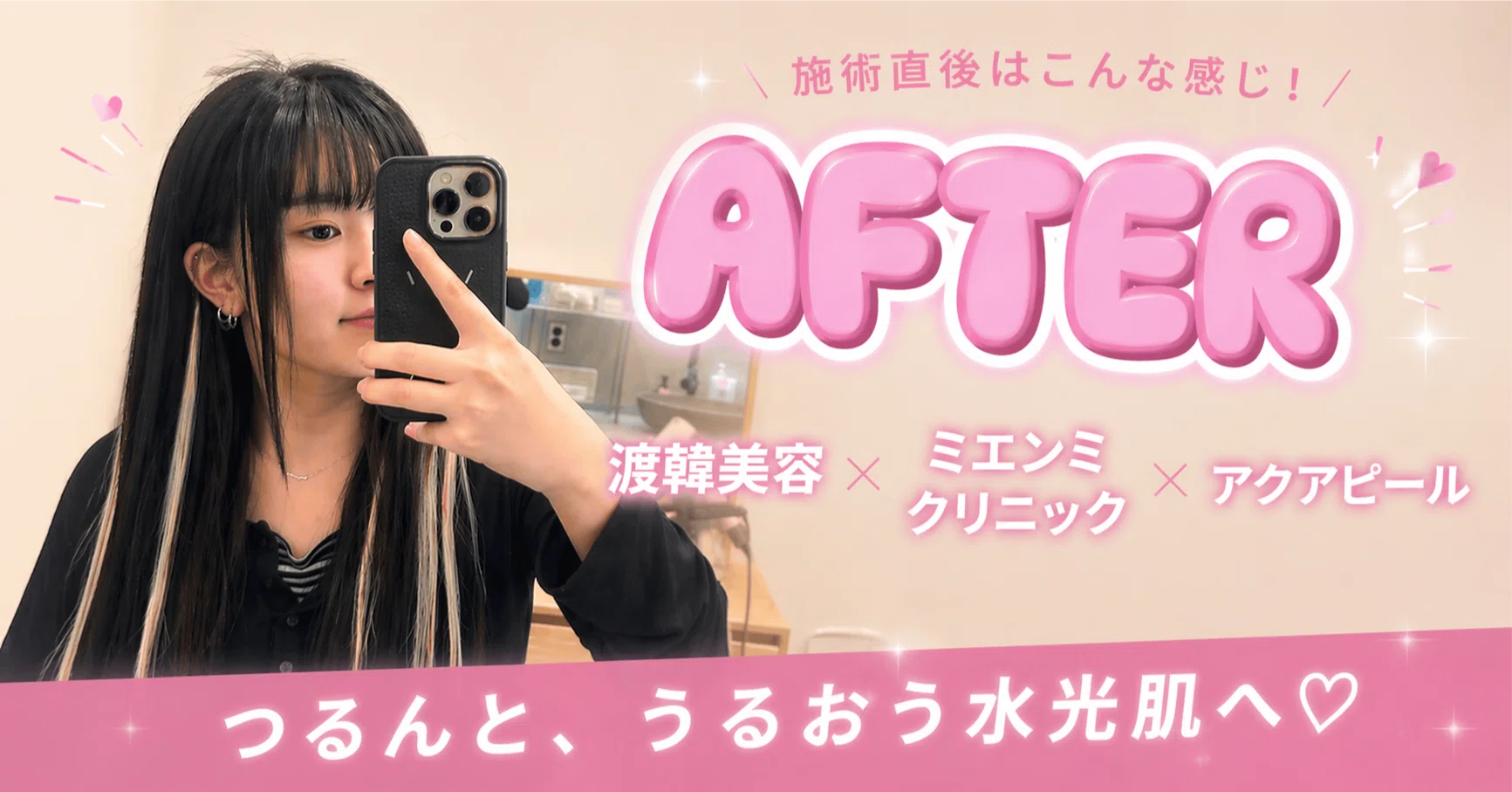韓国美容】106.江南の肌管理ならミエンミクリニック｜アクアピール