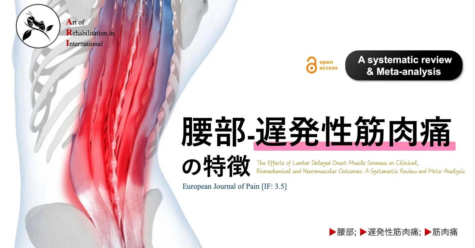 腰部 - 遅発性筋肉痛の特徴｜Super Human | 理学療法士／保健学博士 Ph.D.
