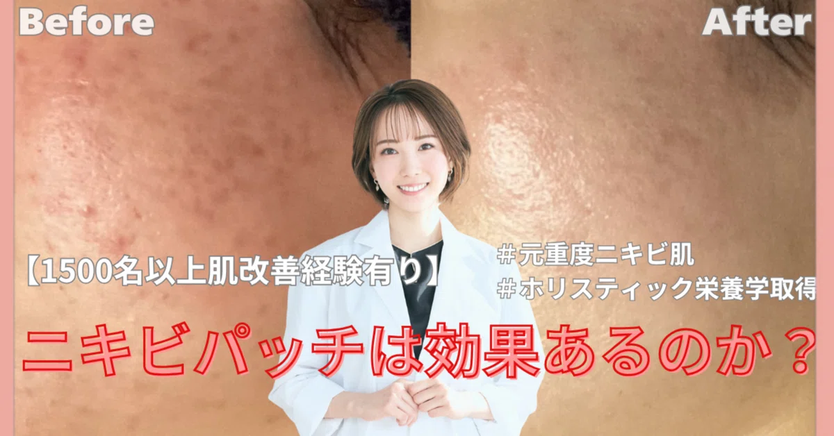 [Essential Guide] For those of you who use acne patches but still can't ...