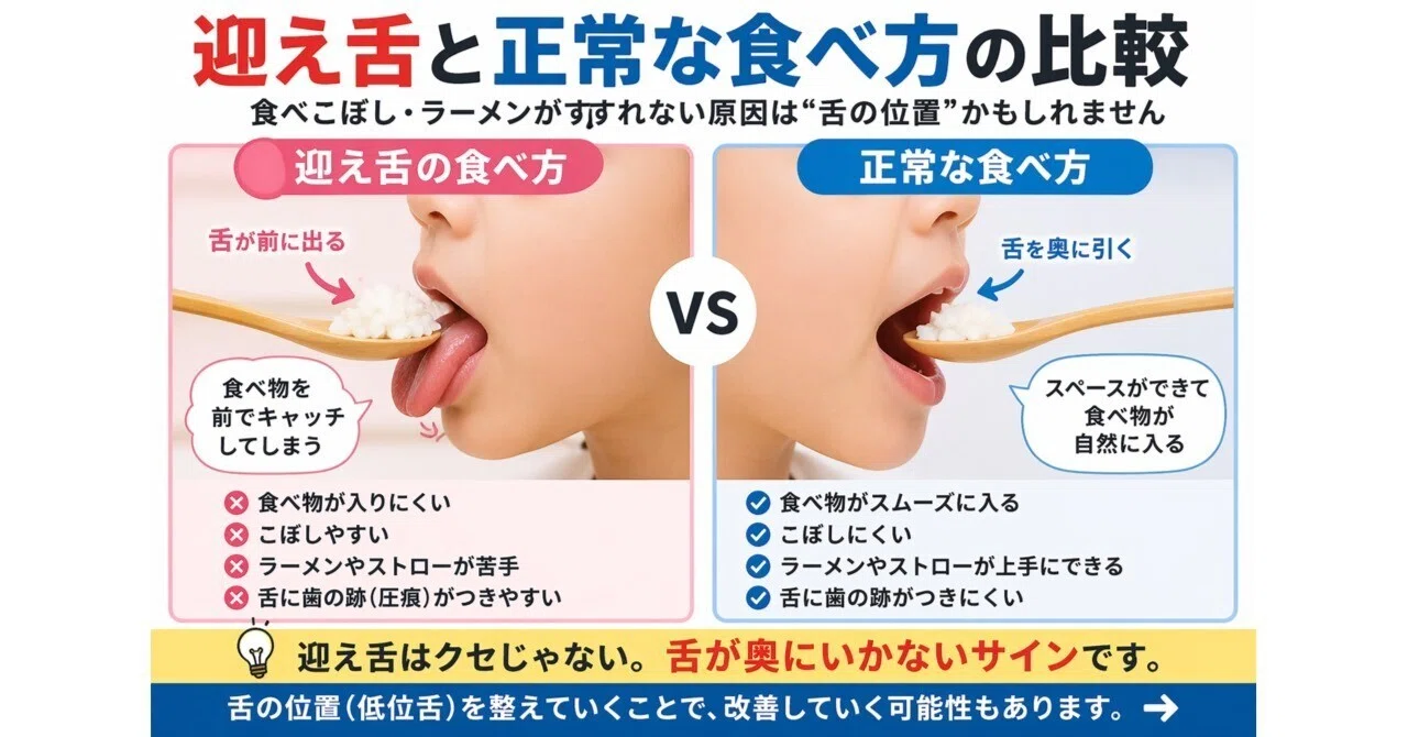 迎え 舌 と は