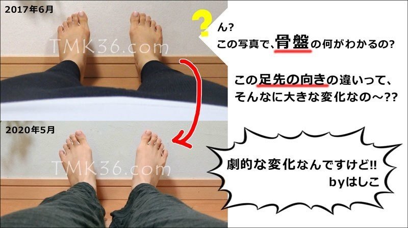 骨盤を整えるだけで ここまでの効果があるとは思ってなかった 覆面はしこ 美容オタク Note 骨盤を整えるだけで ここまでの効果があるとは思ってなかった 覆面はしこ 美容オタク Note