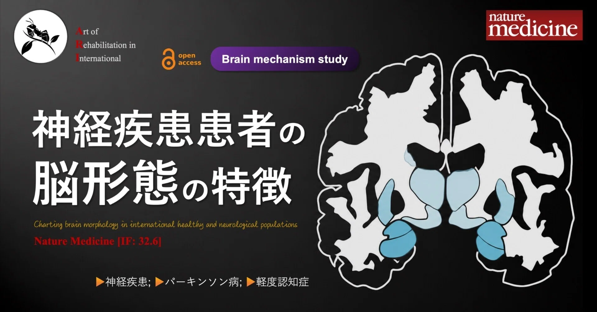 神経疾患患者の脳形態の特徴｜Super Human | 理学療法士／保健学博士 Ph.D.