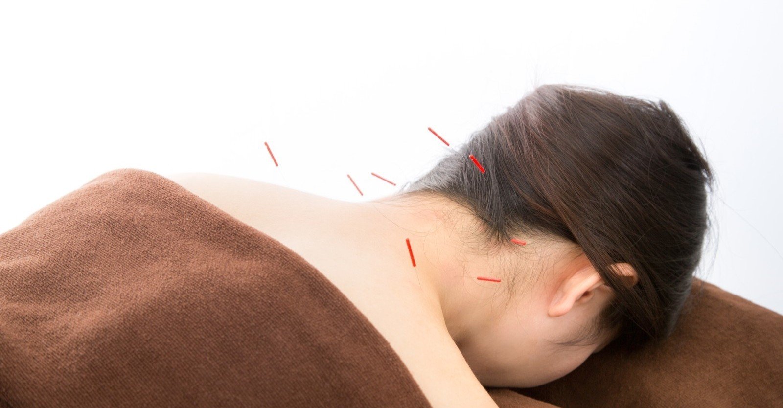 中国針灸刺灸法 針灸学［手技篇］ | 単行本,鍼灸 | 東洋学術出版社 WEB STORE