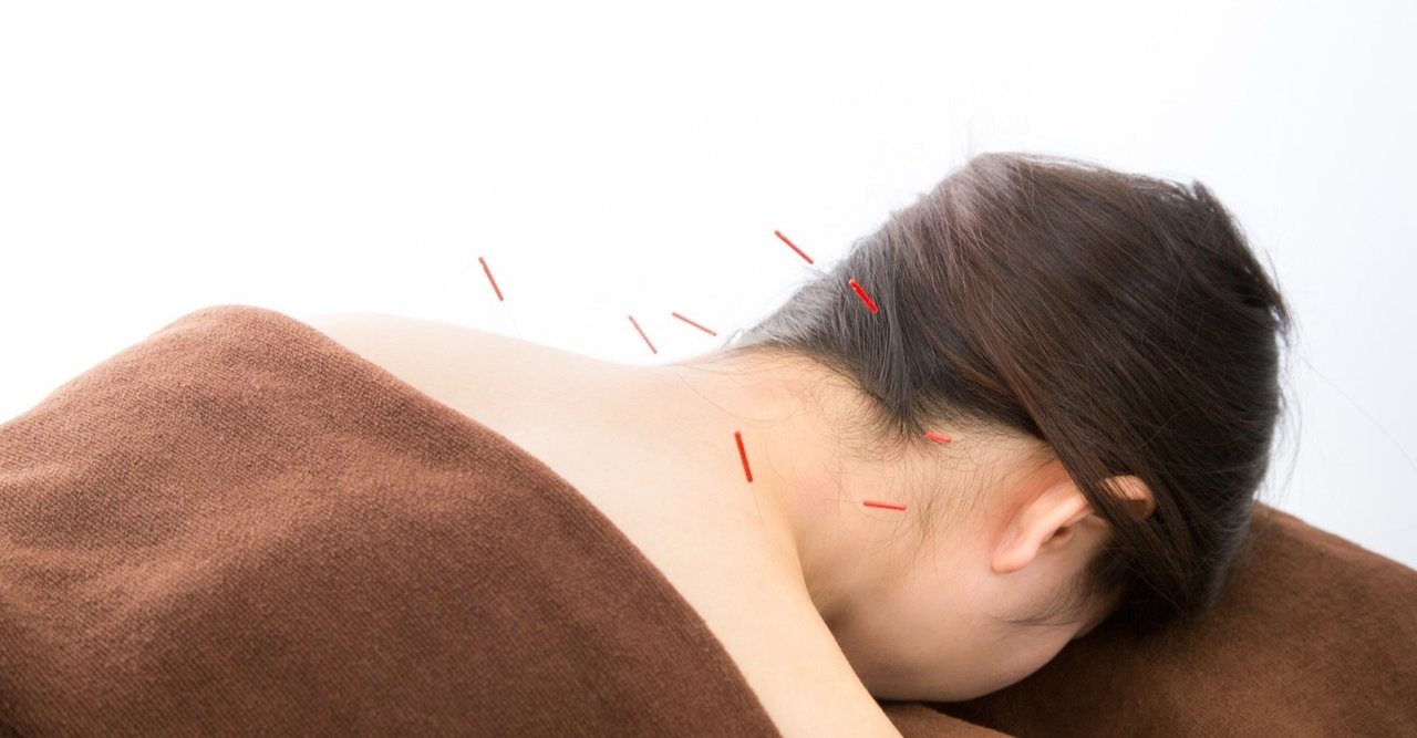 週2回の鍼治療は可能ですか？