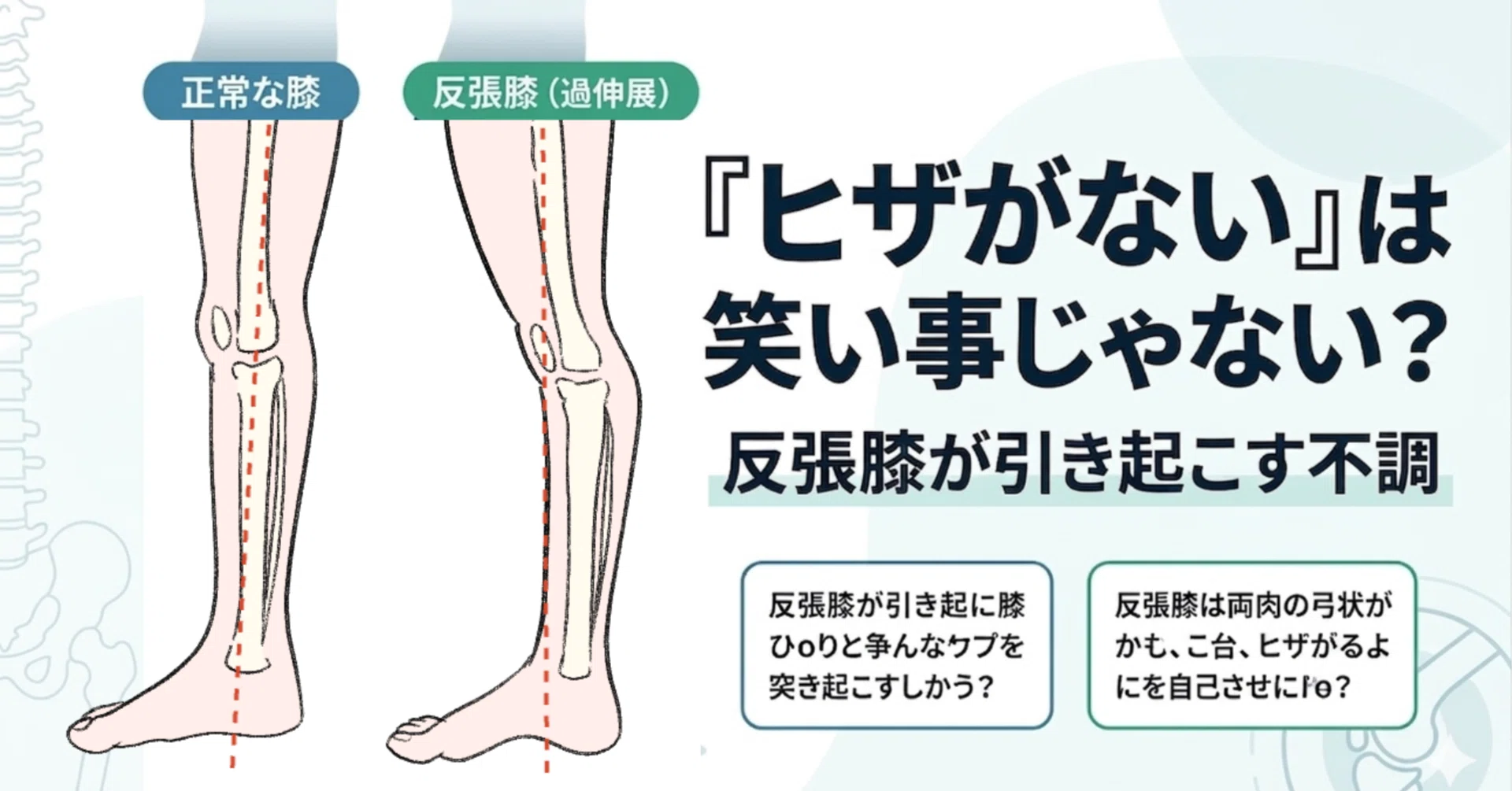 ヒザがない」は笑い事じゃない？ぐんぴぃさん現象と『反張膝』の