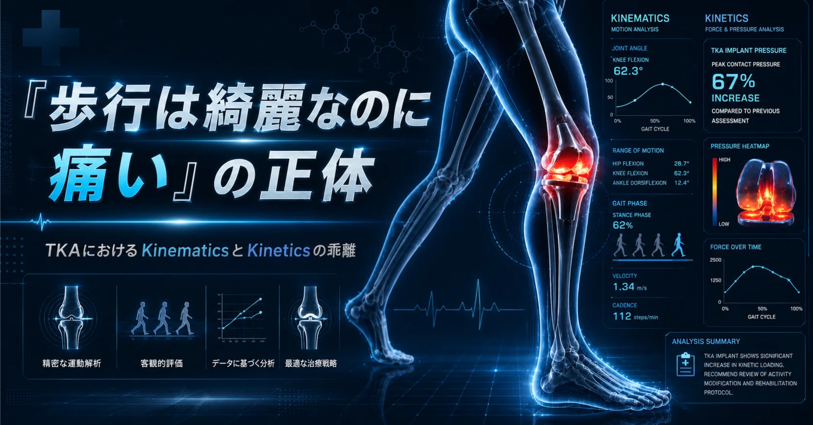 歩行は綺麗なのに痛い」の正体－TKAにおけるKinematicsとKineticsの
