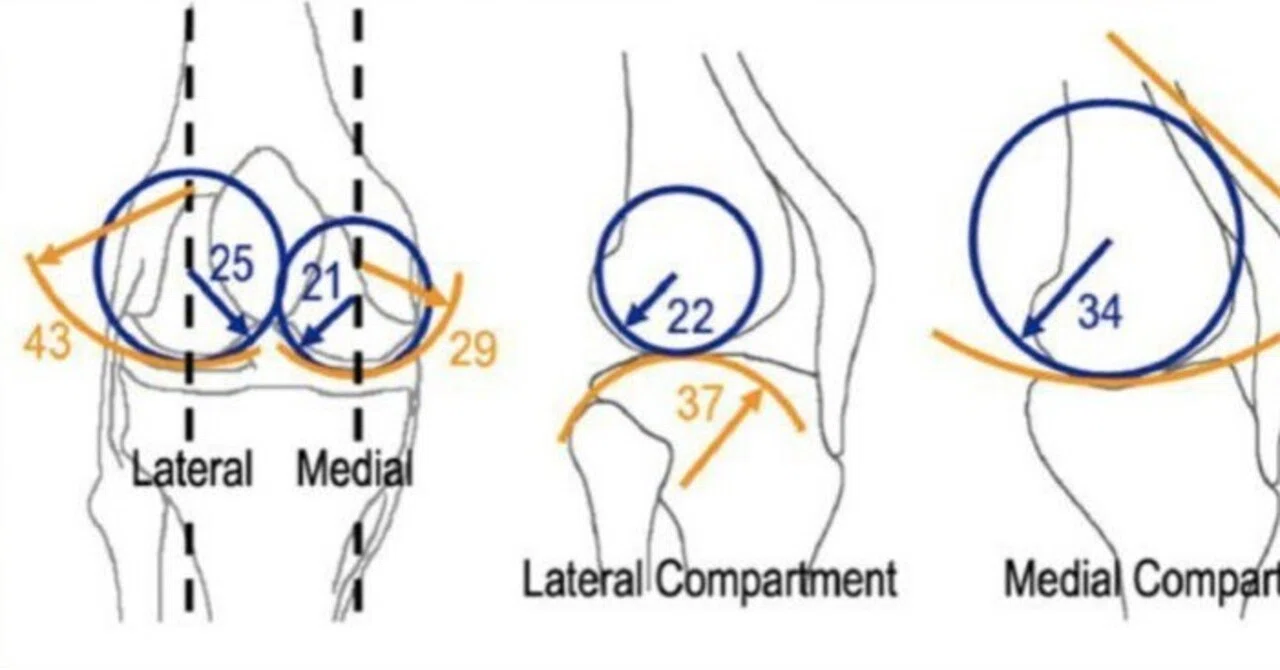 Medial Pivot motionについて｜Stumpy
