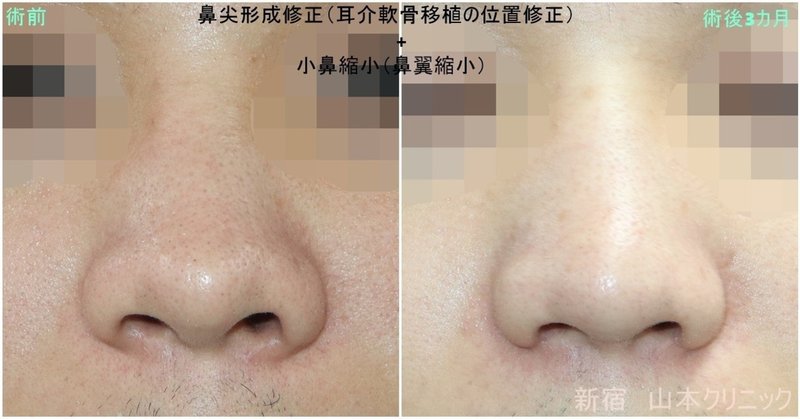 小鼻小さく の新着タグ記事一覧 Note つくる つながる とどける