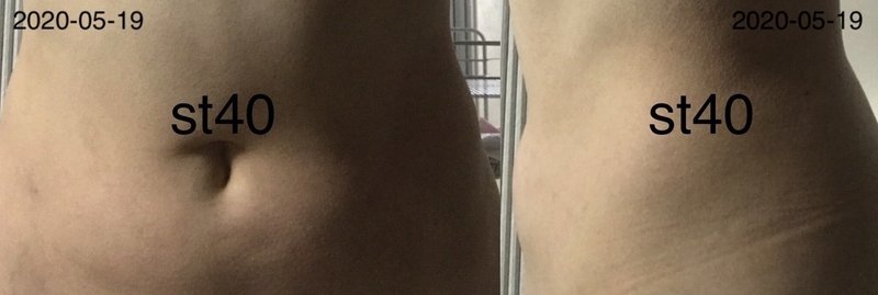 コアリズム４週間 St40 Note