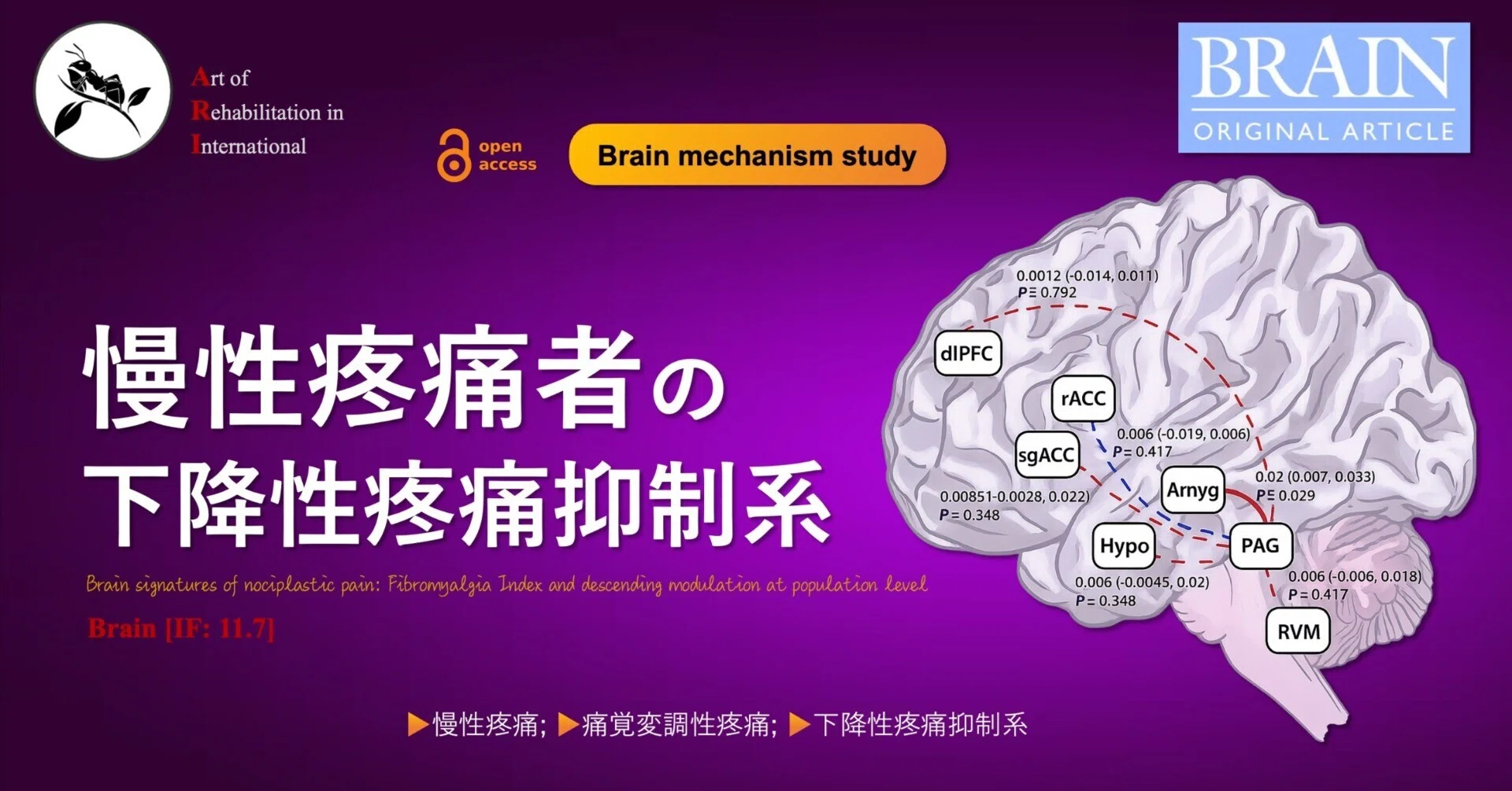 ハーネマンによる慢性病理論 慢性疼痛者の下降性疼痛抑制系｜Super Human | 理学療法士／保健学博士