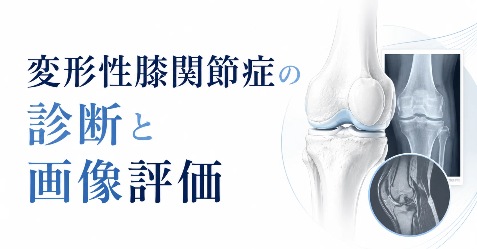 変形性膝関節症の診断と画像評価：レントゲンの「外」にある真実を
