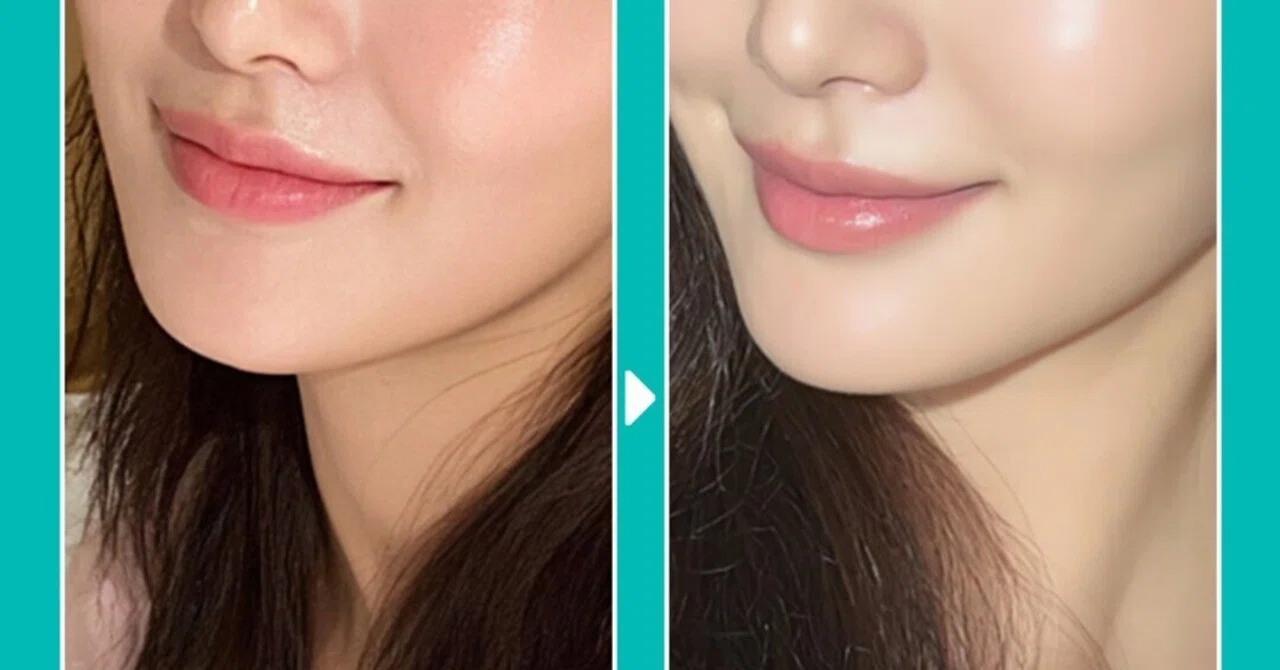 What is Rejuran? Why it is popular for those aiming for natural ...