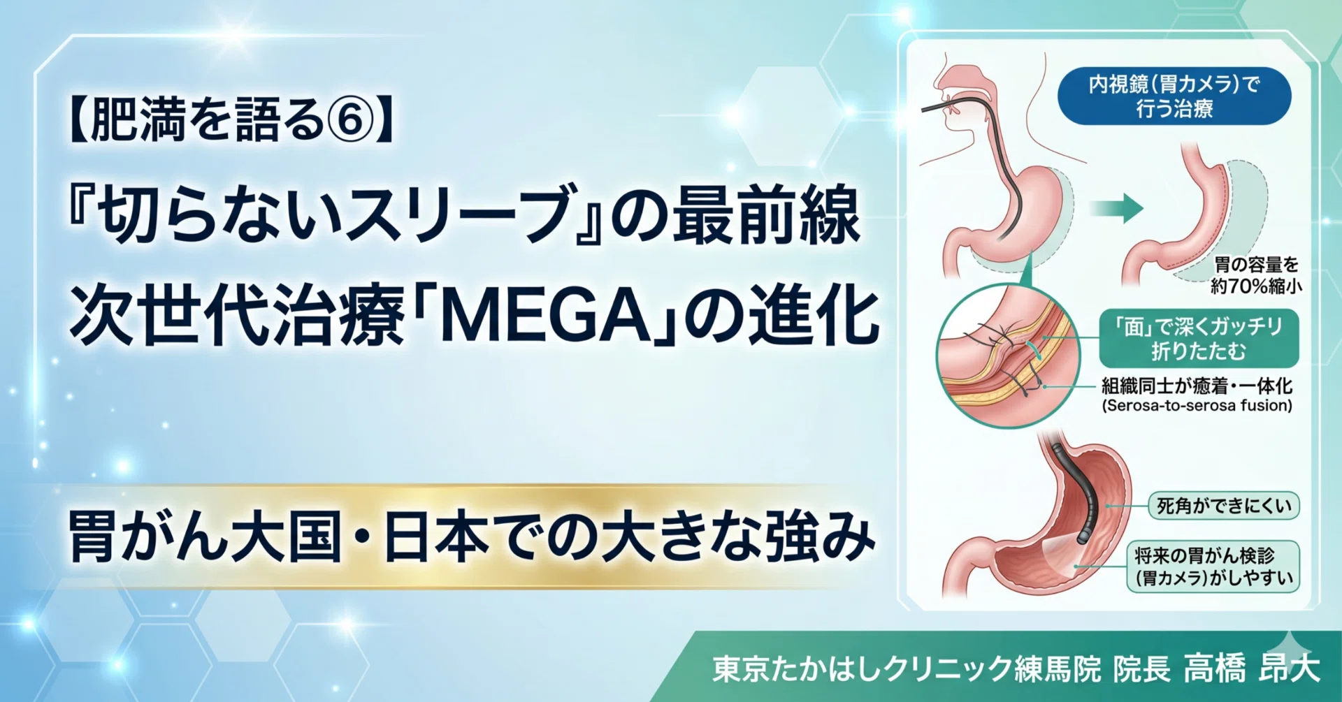 肥満を語る⑥】「切らないスリーブ」の最前線。次世代治療「MEGA」の