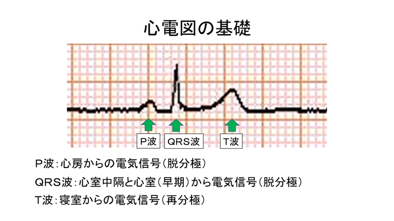 分かる 波形と間隔 川野 貴久 分かりやすい心電図 Note