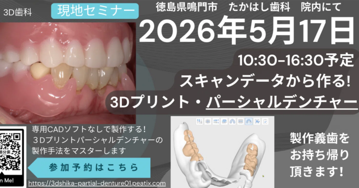 購読不要・購入しないで)「スキャンデータから作る！3Dプリント 