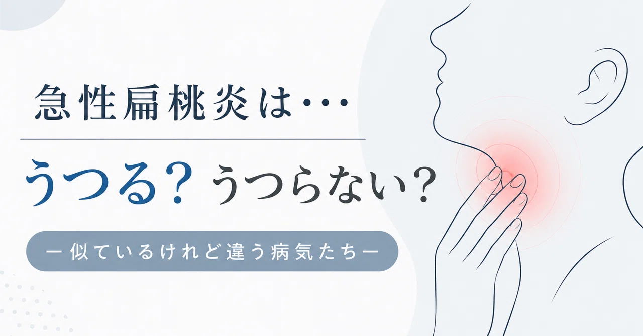 急性扁桃炎は・・・うつる？うつらない？ー似ているけれど違う病気たち｜よしなが