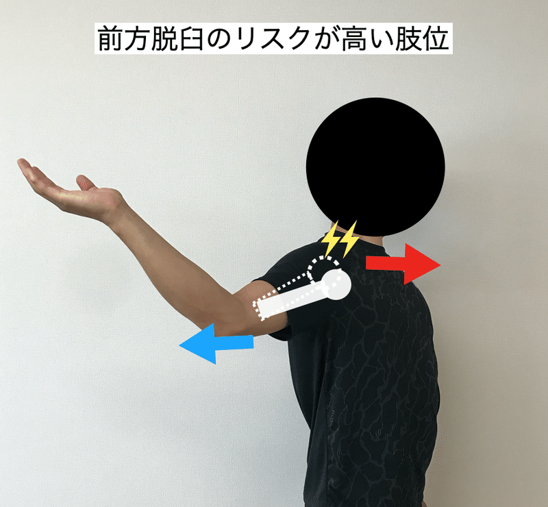 野球選手の 肩関節脱臼 は致命傷 深町太一朗 Note