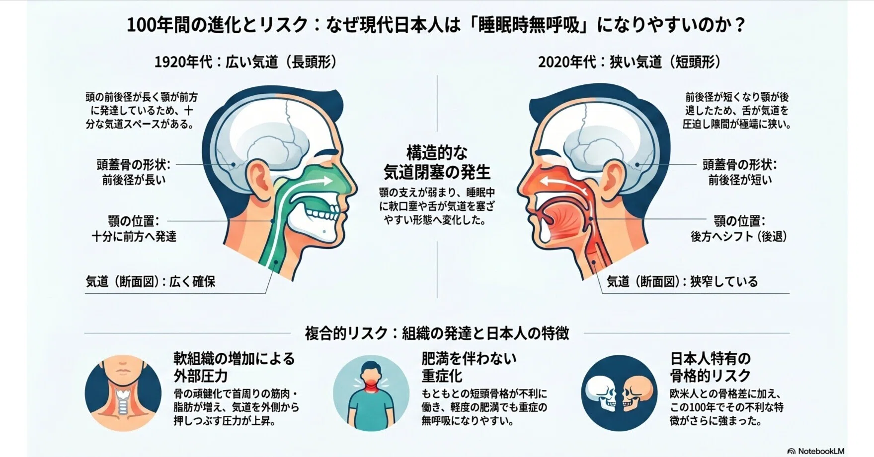 日本人の顔が変わったらしい・・・閉塞型無呼吸が起こりやすくなった