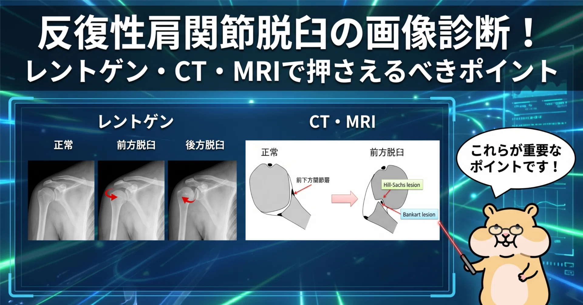 反復性肩関節脱臼の画像診断！レントゲン・CT・MRIで押さえるべき