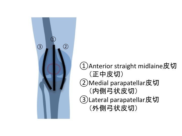 関節の構造と機能 セラピストが知っておくべき手術の知識-人工股関節と人工膝関節