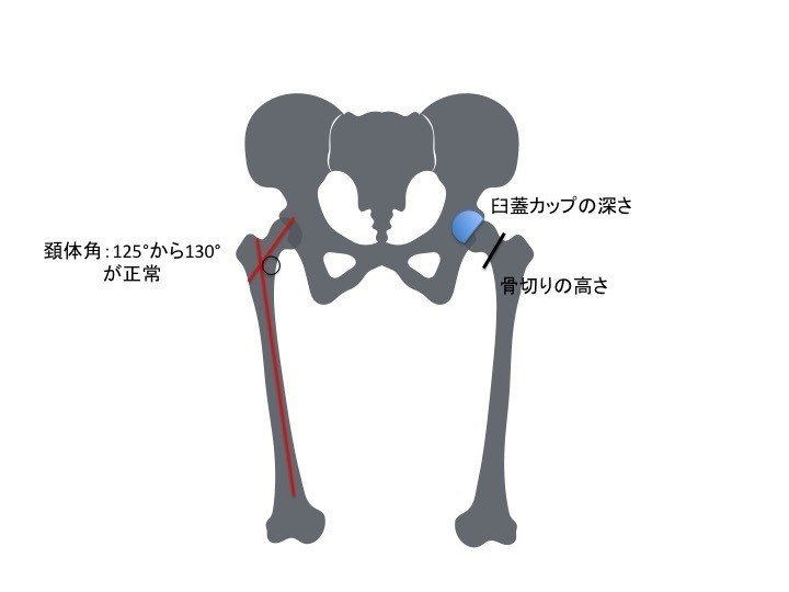 関節の構造と機能 関節の機能と構造｜ショウイチロウ