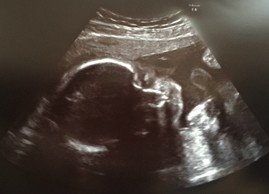 我が家の一人目妊娠レポ3 妊娠後期 ヒナ Note 我が家の一人目妊娠レポ3 妊娠後期 ヒナ Note