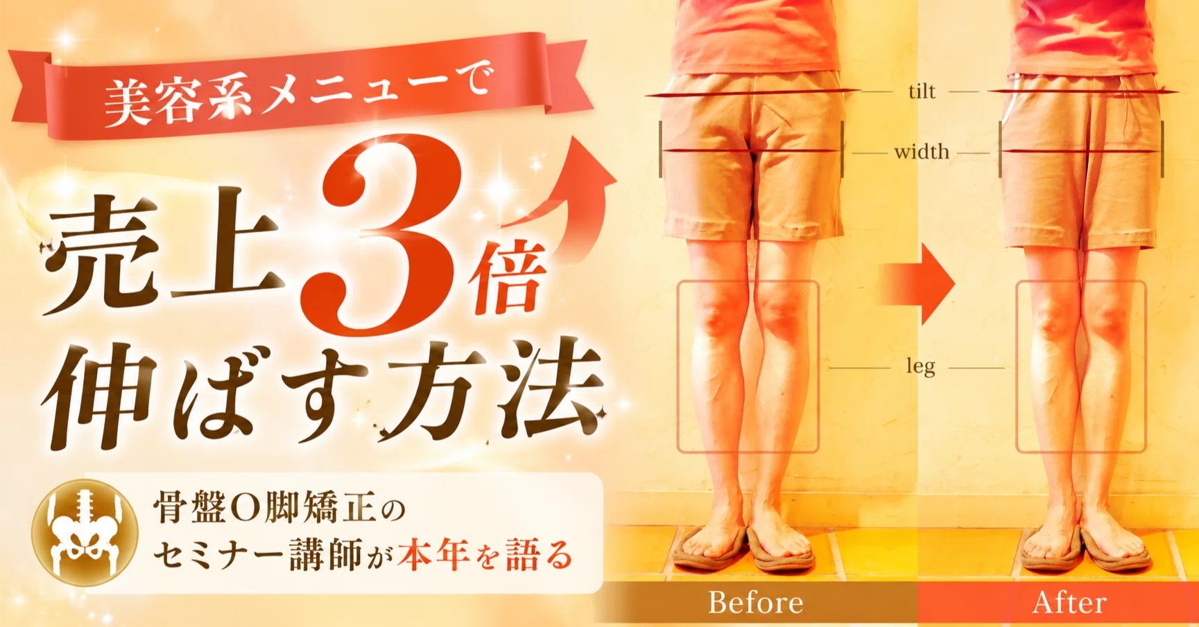 【 魅せる治療Part2＆O脚矯正セミナー 】DVD２本セット 魅せる治療Part2 & O脚矯正セミナー 【公式通販】