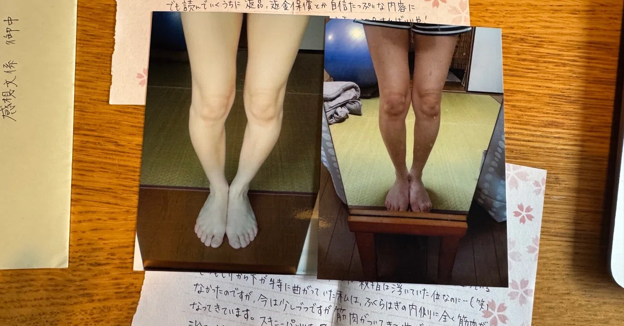 膝下O脚「ありとあらゆるO脚グッズを試し、O脚矯正のエステや整体にも