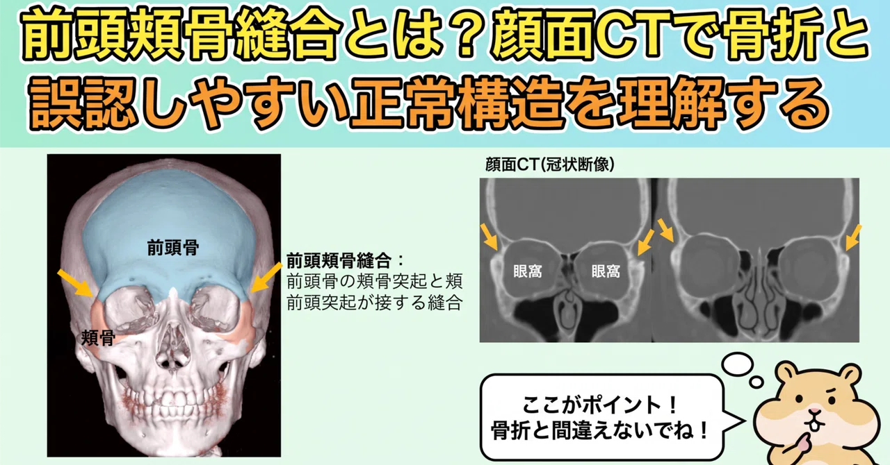 What is the frontozygomatic suture? Understanding normal structures ...
