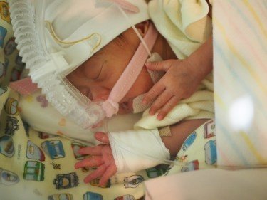 超低出生体重児 Nicu奮闘記 コウノドリ出演 日齢 36 42 修正31週 保育器からコットへ 成川潤 Jun Narikawa Note