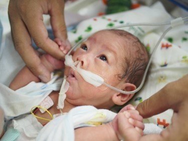 超低出生体重児 Nicu奮闘記 コウノドリ出演 日齢 79 84 修正37週 呼吸器がさらに進化 成川潤 Jun Narikawa Note 超低出生体重児 Nicu奮闘記 コウノドリ出演 日齢 79 84 修正37週 呼吸器がさらに進化 成川潤 Jun Narikawa Note