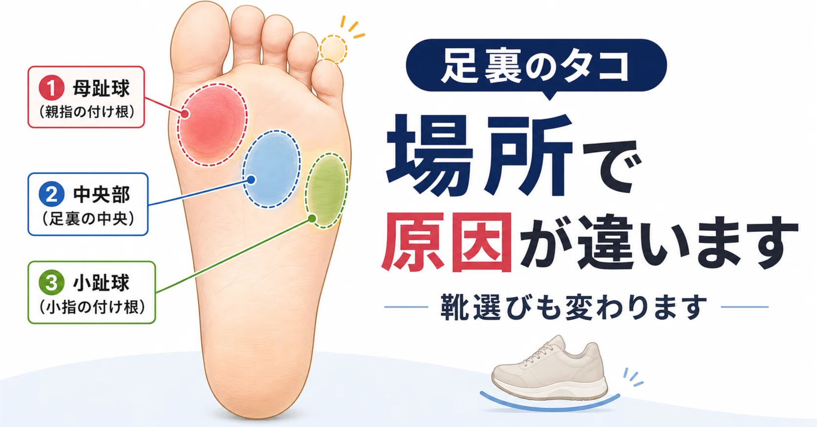 足 の 裏 の タコ