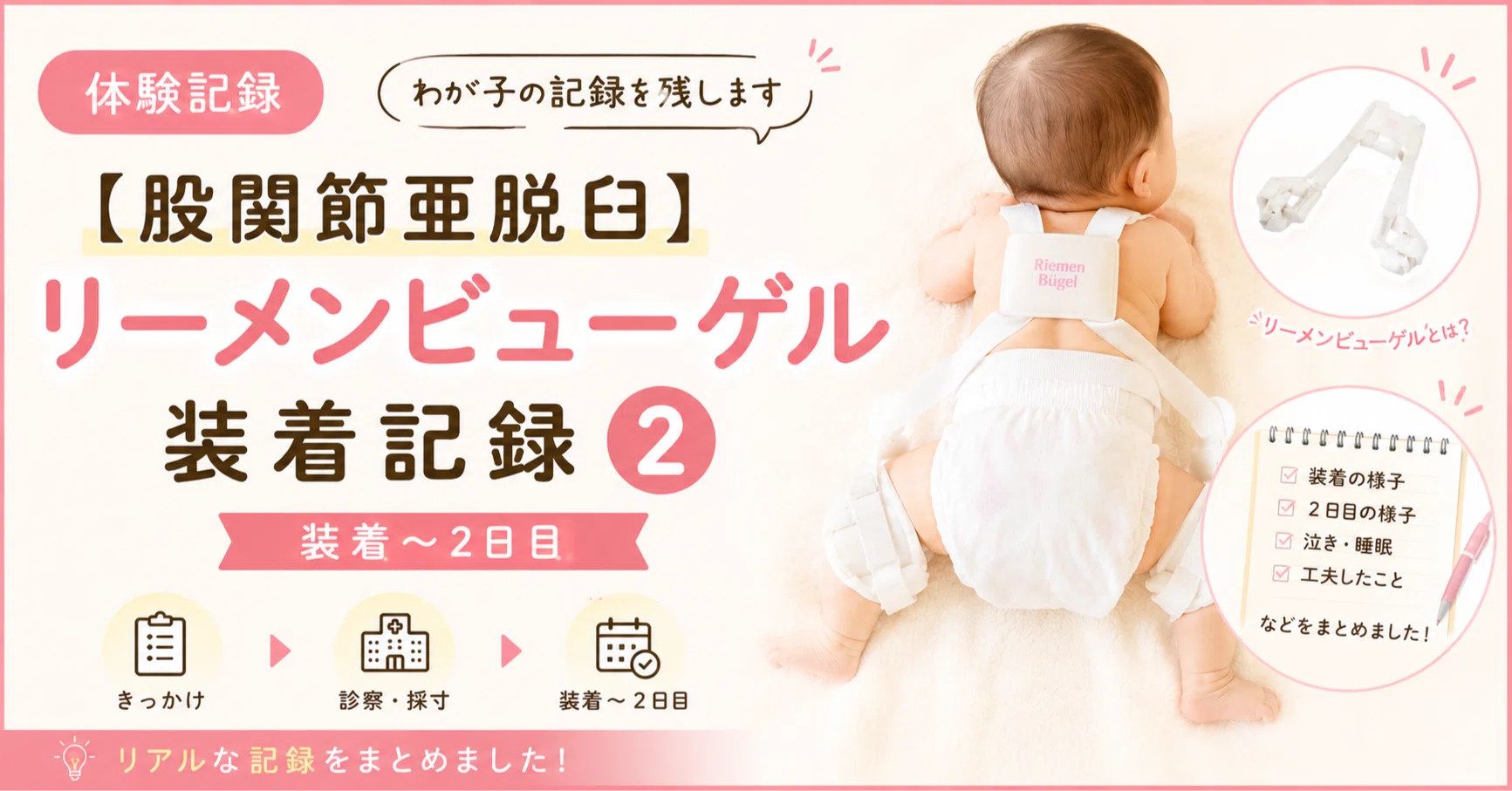 股関節亜脱臼】リーメンビューゲル装着記録②｜装着〜2日目｜0歳児ココママ