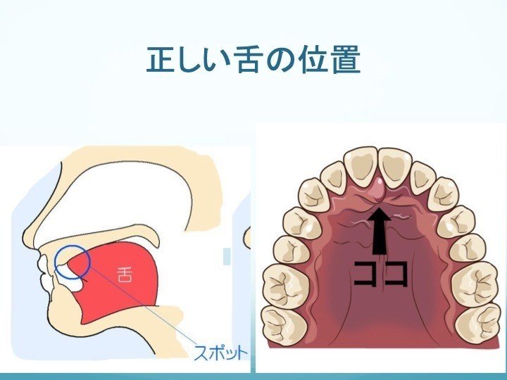 握力が弱い よく転ぶのも口に強い関係があるんです なりとみけんごう Note 握力が弱い よく転ぶのも口に強い関係があるんです なりとみけんごう Note