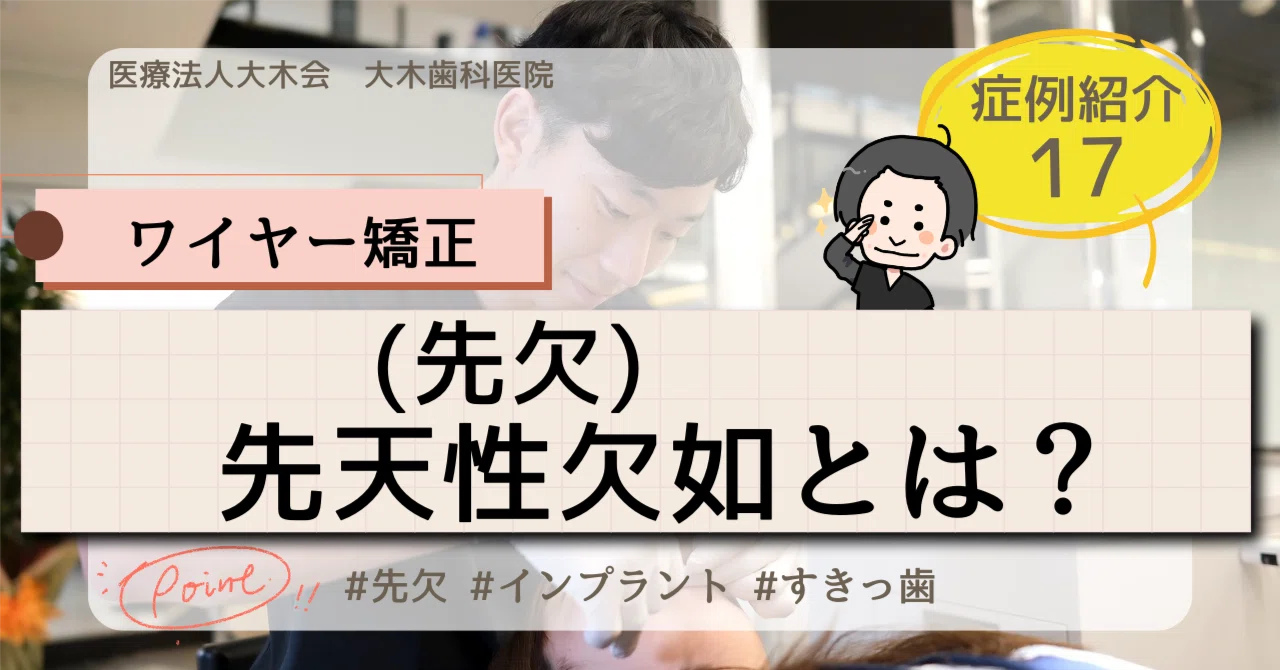 先天性欠如（先欠）とは？｜ワイヤー矯正＋インプラントで治したすきっ