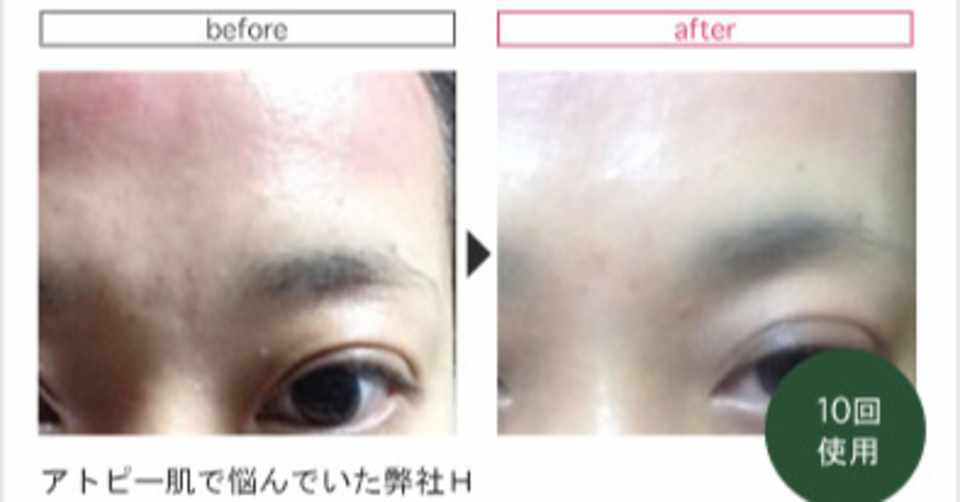 密 シールド 平和な 自宅 で ハーブ ピーリング N373n Net 密 シールド 平和な 自宅 で ハーブ ピーリング N373n Net