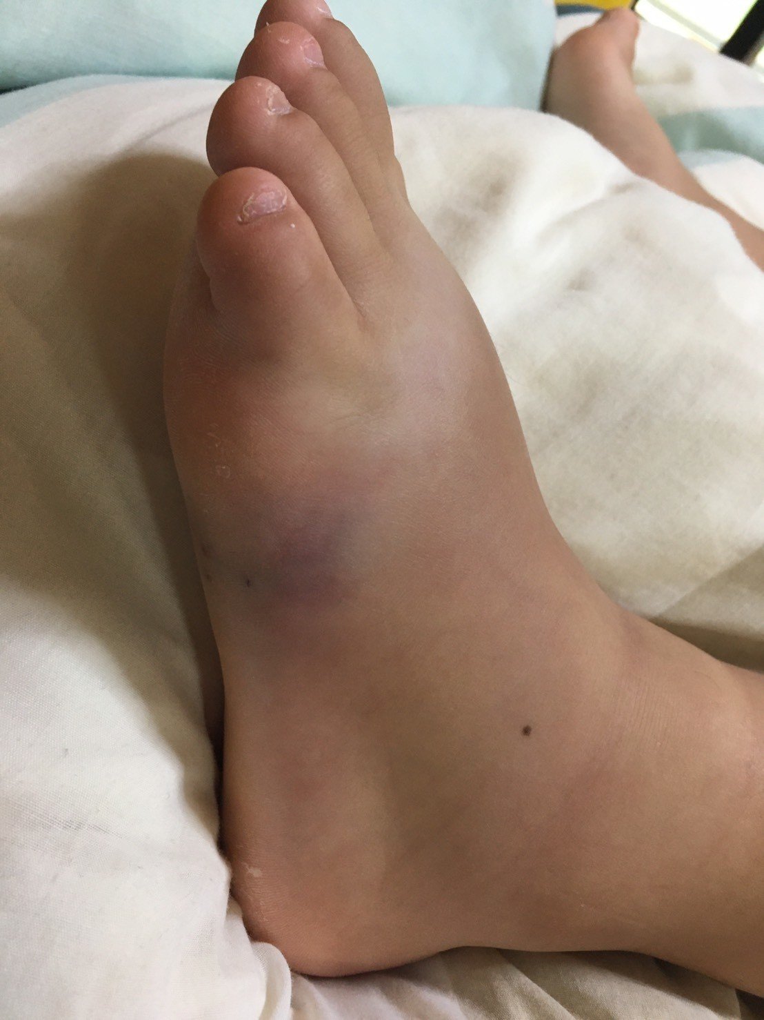 小学生がオニダルマオコゼに刺された 救急搬送までの一部始終 林 将之 Masayuki Hayashi Note 小学生がオニダルマオコゼに刺された 救急搬送までの一部始終 林 将之 Masayuki Hayashi Note