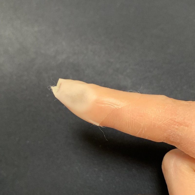 カッターで深く指を切った怪我にキズパワーパッドで湿潤療法した話 46番 Note