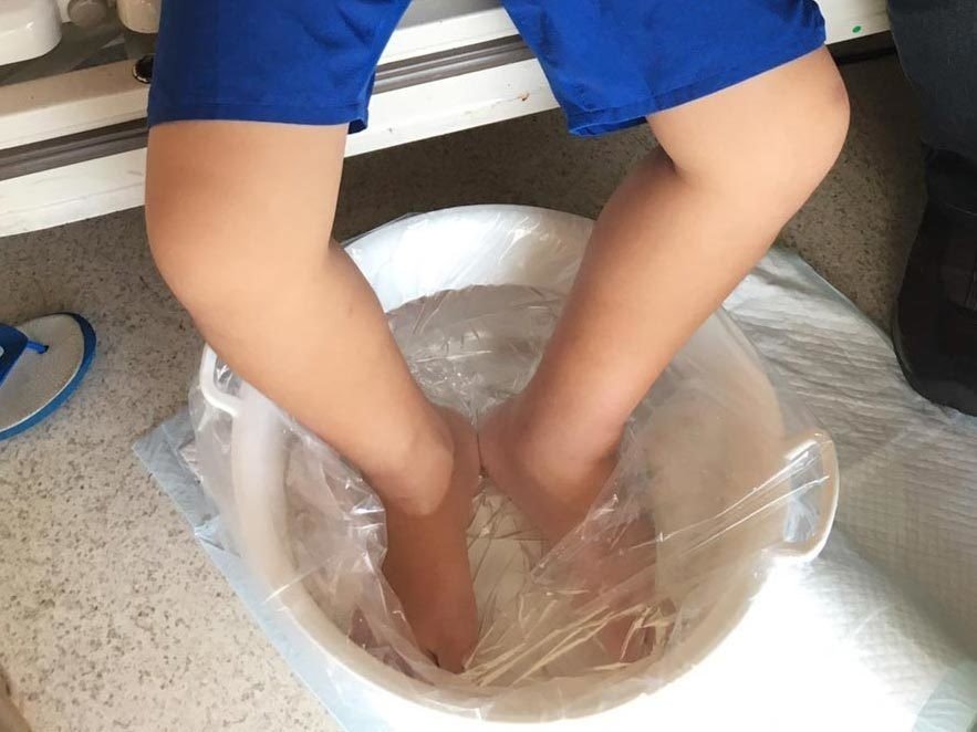 小学生がオニダルマオコゼに刺された 救急搬送までの一部始終 林 将之 Masayuki Hayashi Note 小学生がオニダルマオコゼに刺された 救急搬送までの一部始終 林 将之 Masayuki Hayashi Note