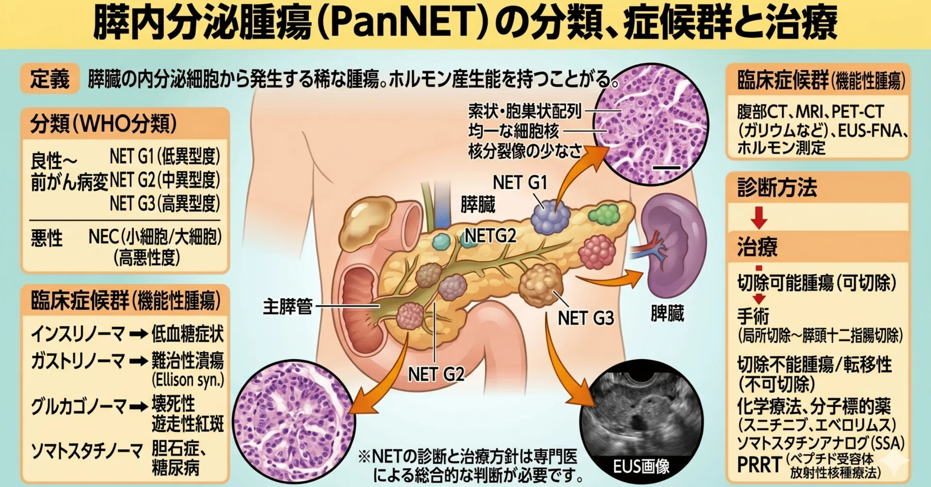 膵内分泌腫瘍｜Theme Japan