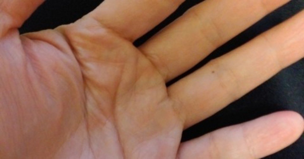 金運 手のひらのほくろ 金運アップのnote Note 金運 手のひらのほくろ 金運アップのnote Note