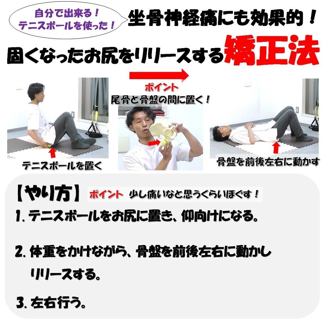 その痛み 坐骨神経痛かも 固くなったお尻をほぐすリリース法 Revisionginza Note その痛み 坐骨神経痛かも 固くなったお尻をほぐすリリース法 Revisionginza Note