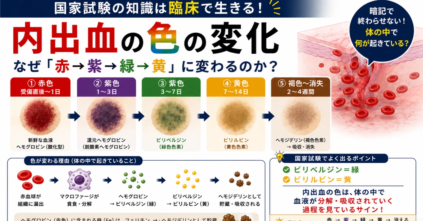 内出血の色の変化｜mizuki